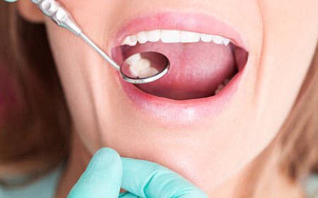 Why Choose Professional Teeth Whitening  Nelson BC?