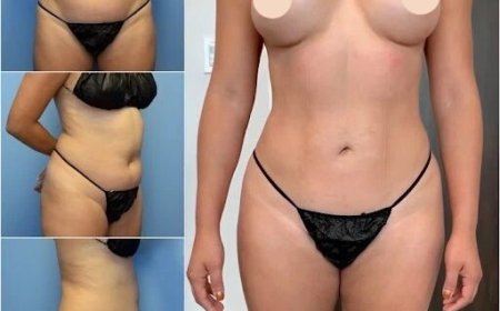 How Body Contouring in Dubai Helps You Achieve Your Dream Physique