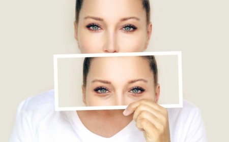 Is Eyelid Bag Surgery in Dubai Worth the Investment for Younger Looking Eyes?