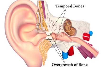 When Sinuses Spin Your World: Understanding and Treating Vertigo