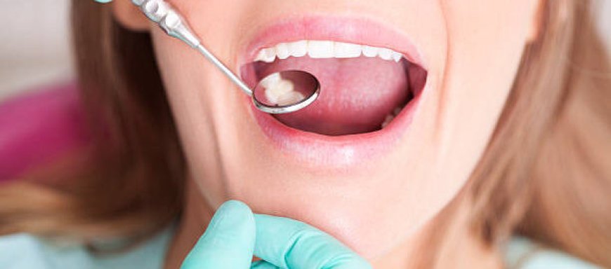 Why Choose Professional Teeth Whitening Nelson BC?