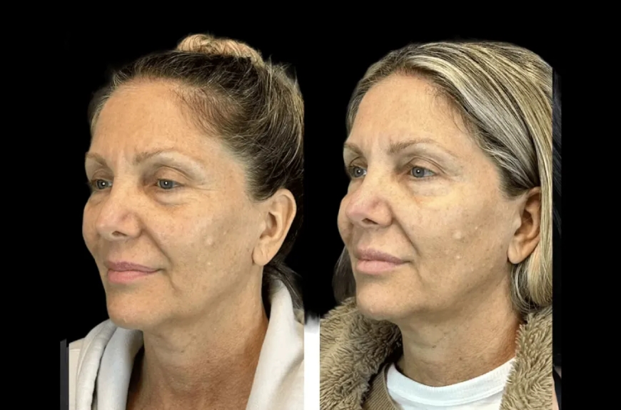 The Ultimate Guide to Choosing the Best Aesthetic Clinic in Dubai
