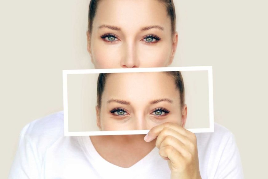 Is Eyelid Bag Surgery in Dubai Worth the Investment for Younger Looking Eyes?