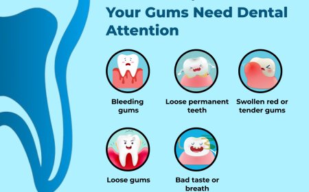 Dental Doctors in Hoodi Bangalore: Your Comprehensive Guide to Quality Oral Care