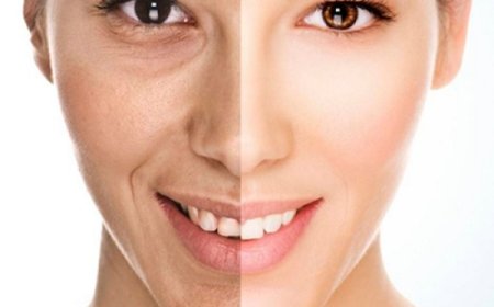 Dermal Fillers vs Botox: Which One Suits Your Skin Goals?