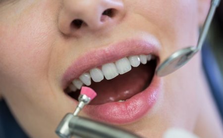 Is Dental Bonding Right for Your Oral Health? Here’s What You Should Know