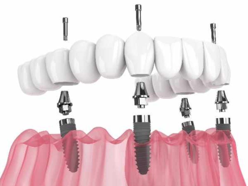 Lasting Results for Your Smile in Banbury