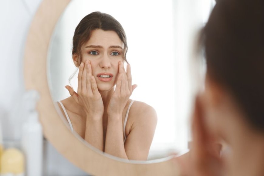 Spot-Free Skin Starts with Isotroin 20mg Capsules