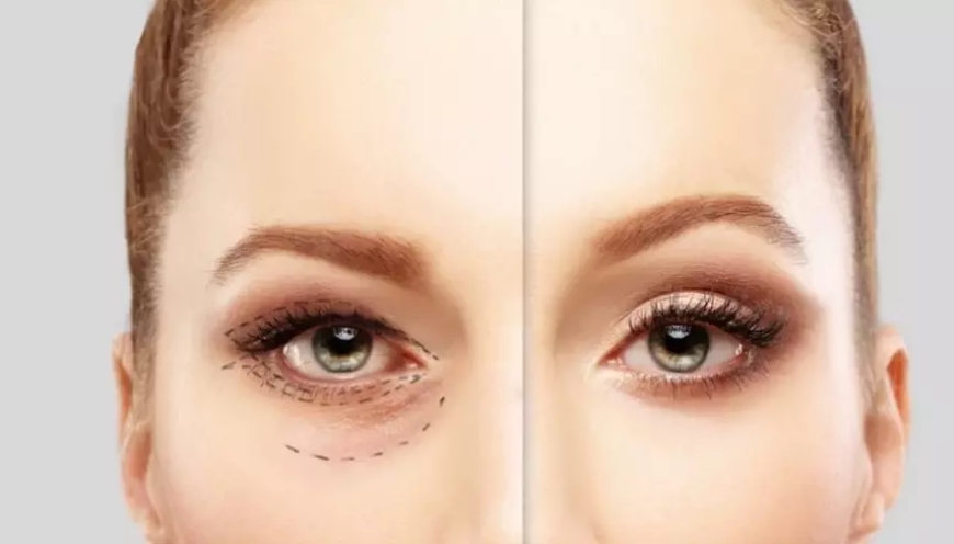 Transforming Beauty: The Rise of Expert Plastic Surgeons in Lahore