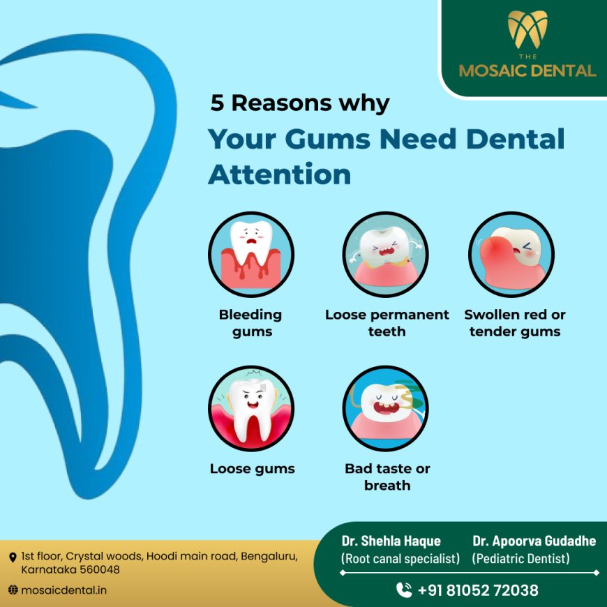 Dental Doctors in Hoodi Bangalore: Your Comprehensive Guide to Quality Oral Care