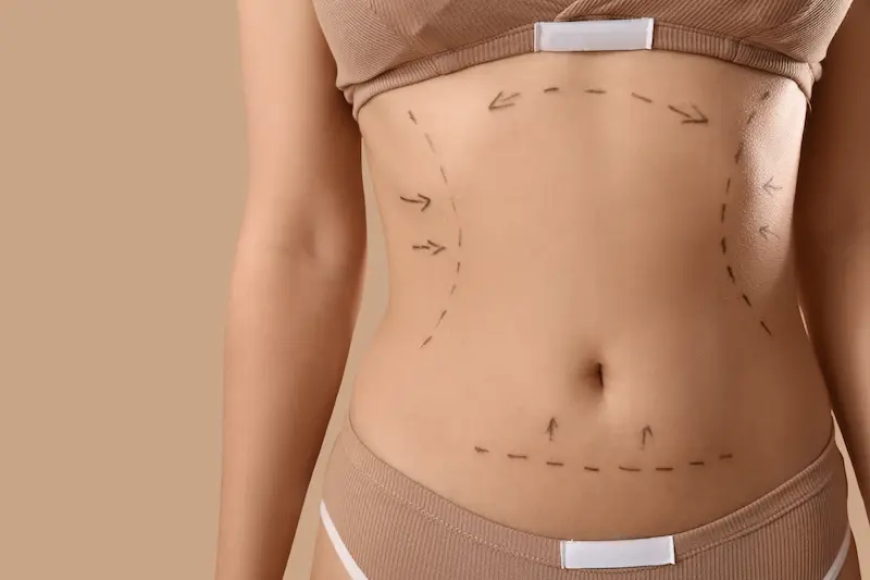 Fat Transfer in Dubai: The Future of Body Contouring and Natural Enhancements