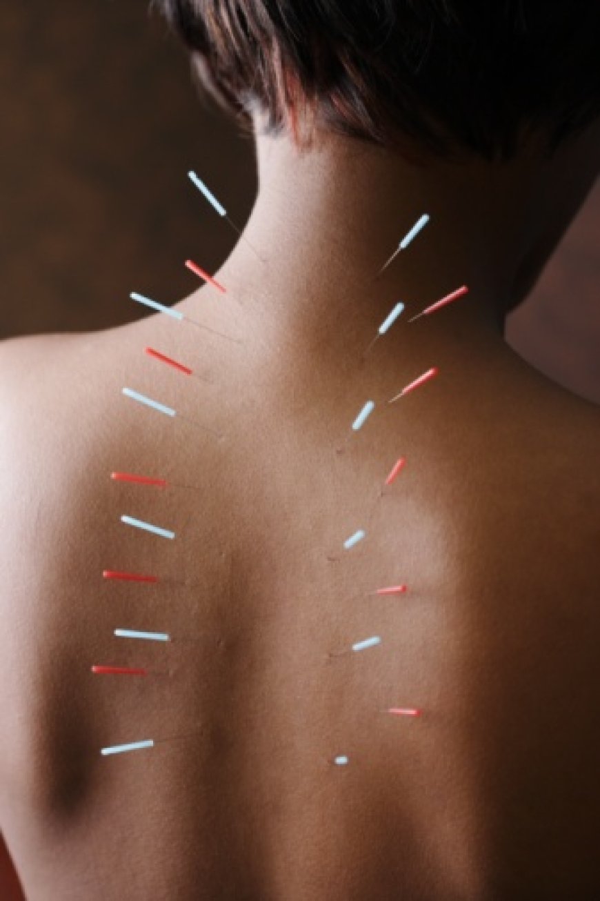 Acupuncture for Menopause Relief: A Natural Way to Rebalance and Restore