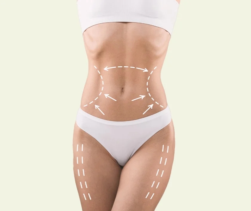 How to Choose the Best Fat Transfer Surgeons in Dubai for Your Desired Results